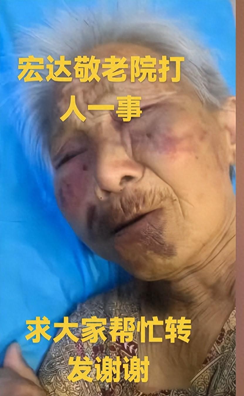 九游游戏-山西养老院暴打85岁老人：打人者真容曝光，身份不一般，官方回应