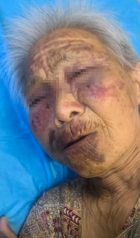 九游游戏-山西养老院暴打85岁老人：打人者真容曝光，身份不一般，官方回应