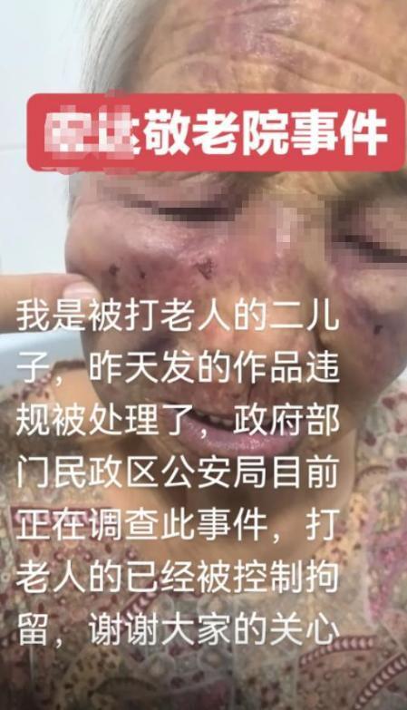 九游游戏-山西养老院暴打85岁老人：打人者真容曝光，身份不一般，官方回应