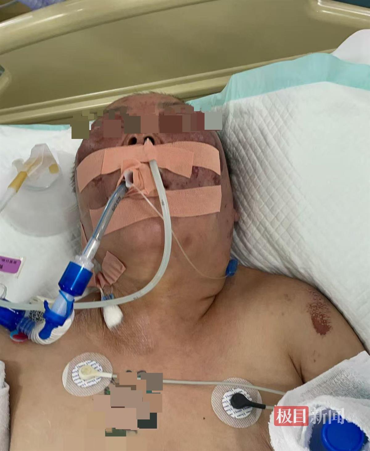 被前夫打进ICU的女子情况仍不稳定,其8岁女儿也曾遭父亲扇脸,律师:已构成故意伤害罪,或同时涉虐待罪